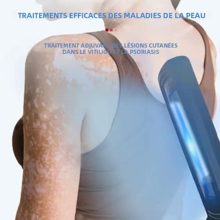Lampe UVB pour la thérapie du psoriasis, lampe de traitement cutané, lumière ultraviolette à bande étroite 311 nm, instrument de photothérapie pour le vitiligo