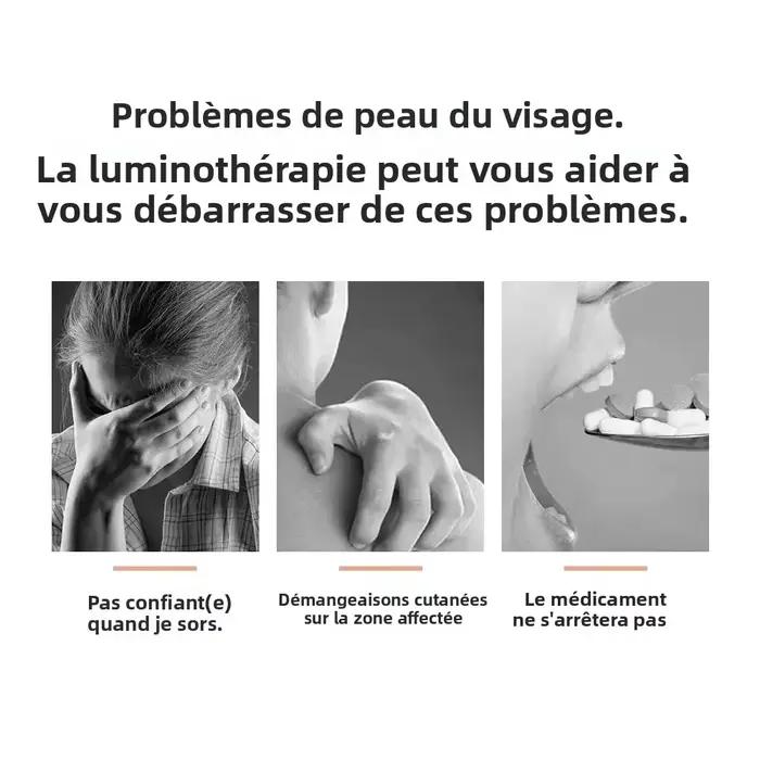 Lampe UVB pour la thérapie du psoriasis, lampe de traitement cutané, lumière ultraviolette à bande étroite 311 nm, instrument de photothérapie pour le vitiligo